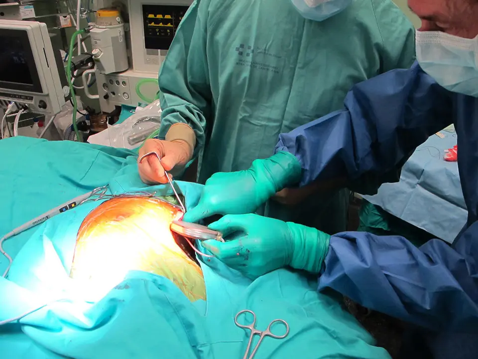 Los cardi&oacute;logos de La Candelaria implantan los desfribriladores subcut&aacute;neos sin cables a pacientes  seleccionados con riesgo de muerte s&uacute;bita por arritmia