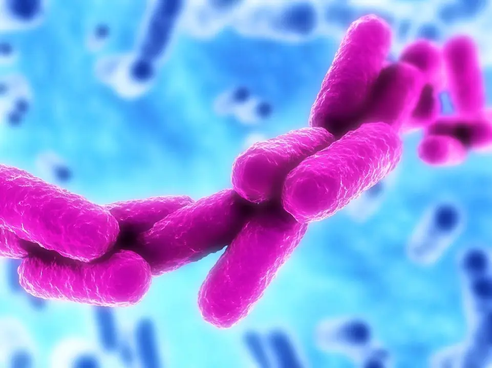 Klebsiella pneumoniae OXA 48
