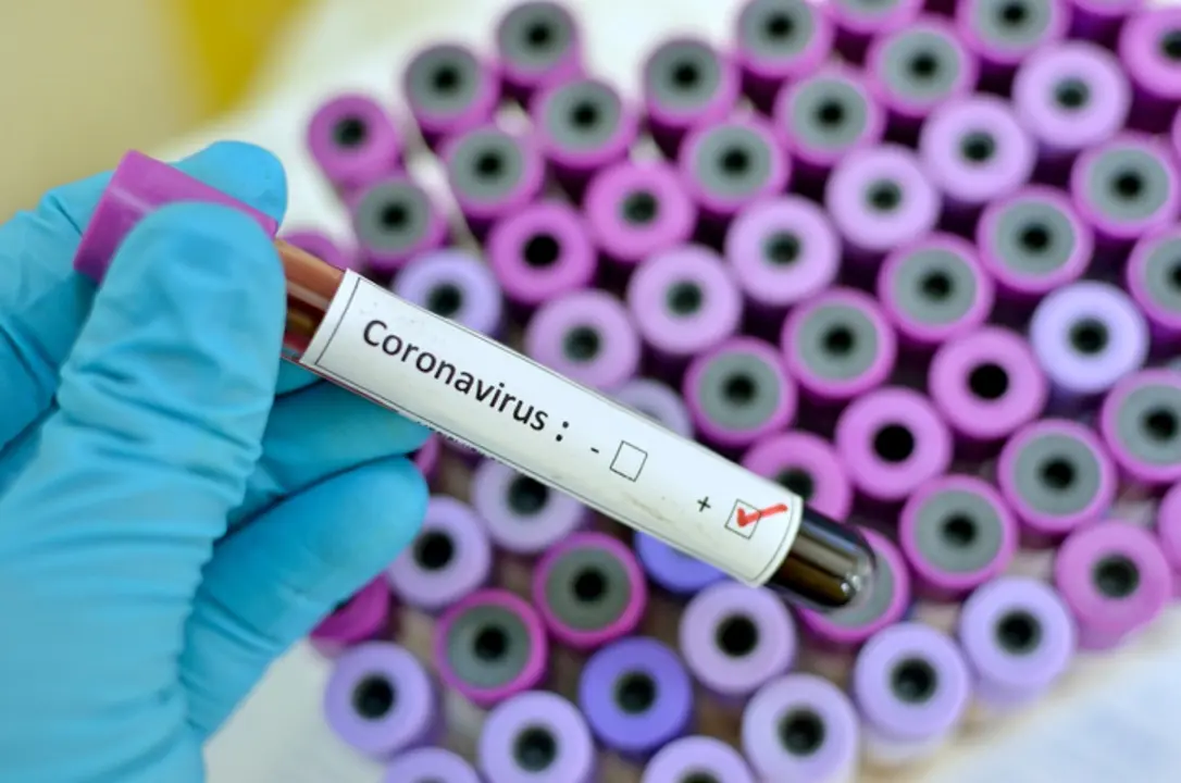 coronavirus_ convid-19 Fotor