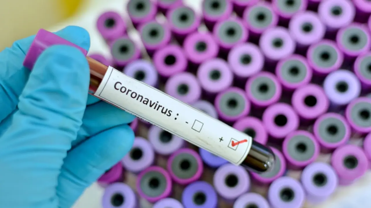 coronavirus_ convid-19 Fotor