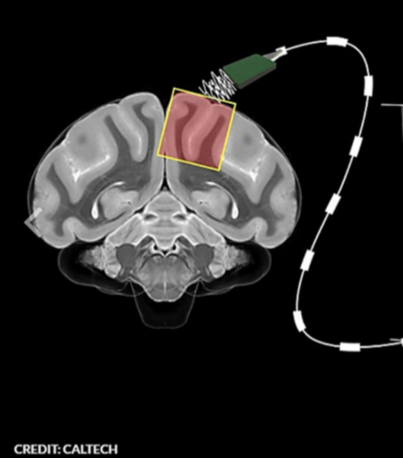Ultrasonidos medicina del futuro_JA (1)
